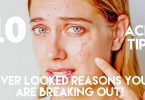 10 IGNORED REASONS YOU ARE BREAKING OUT ACNE